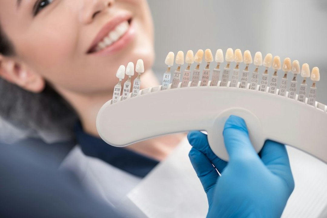 woman getting veneers
