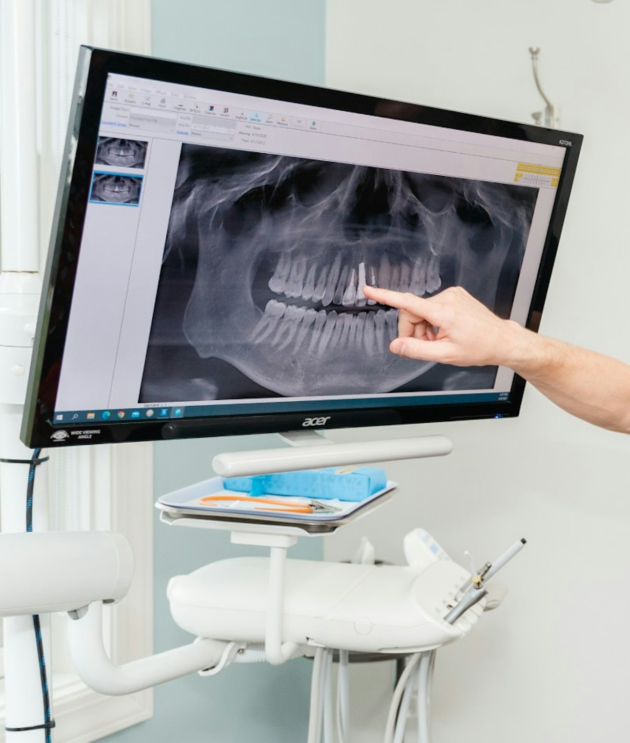 Xrays