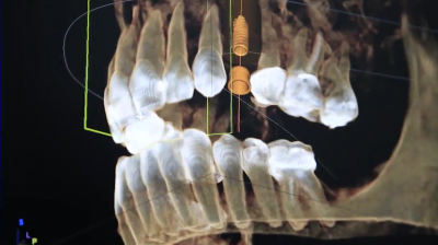 3D imaging