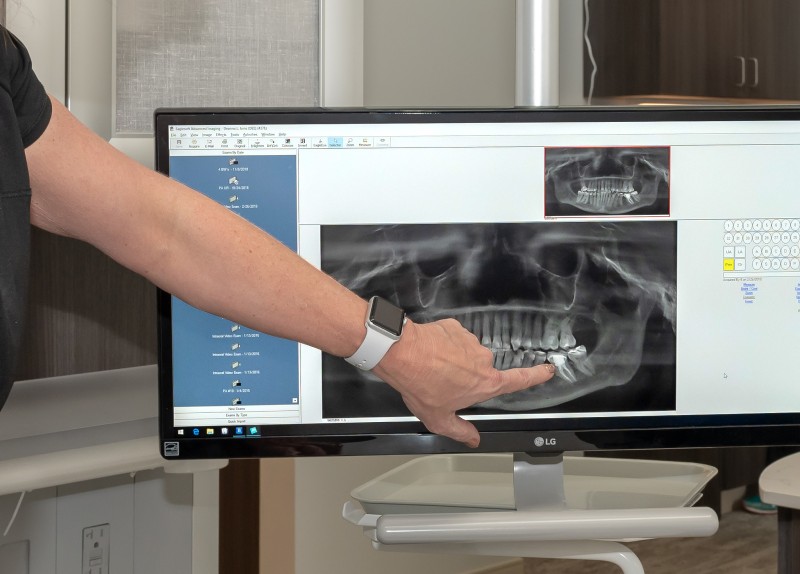 xrays