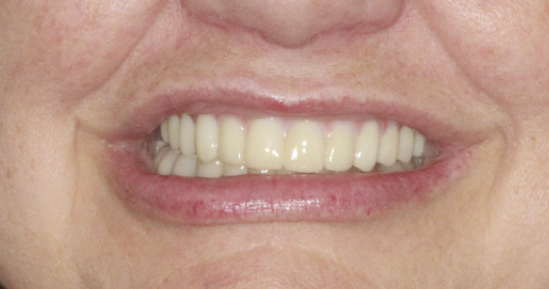 patient after