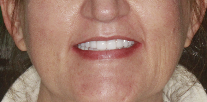 patient after
