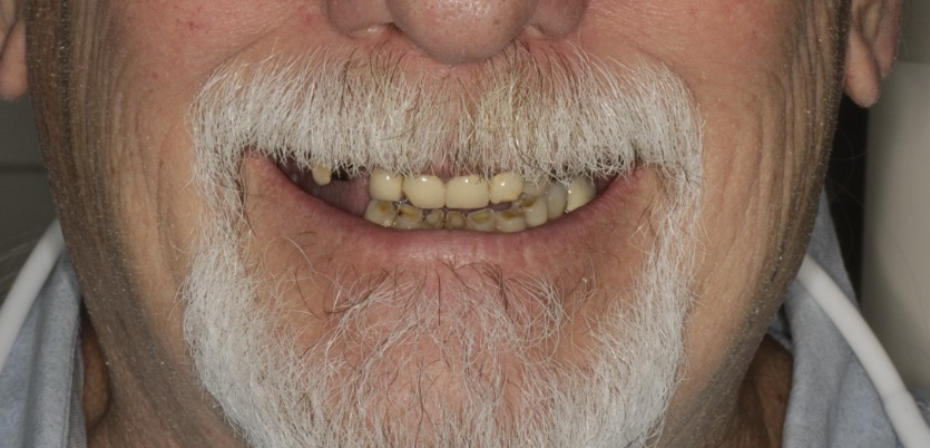 Before patient
