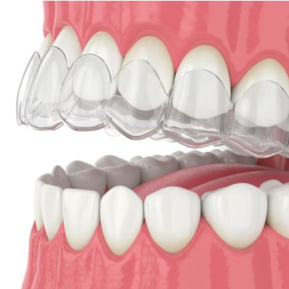 plastic aligners